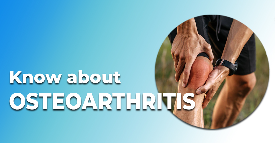 Know about OSTEOARTHRITIS