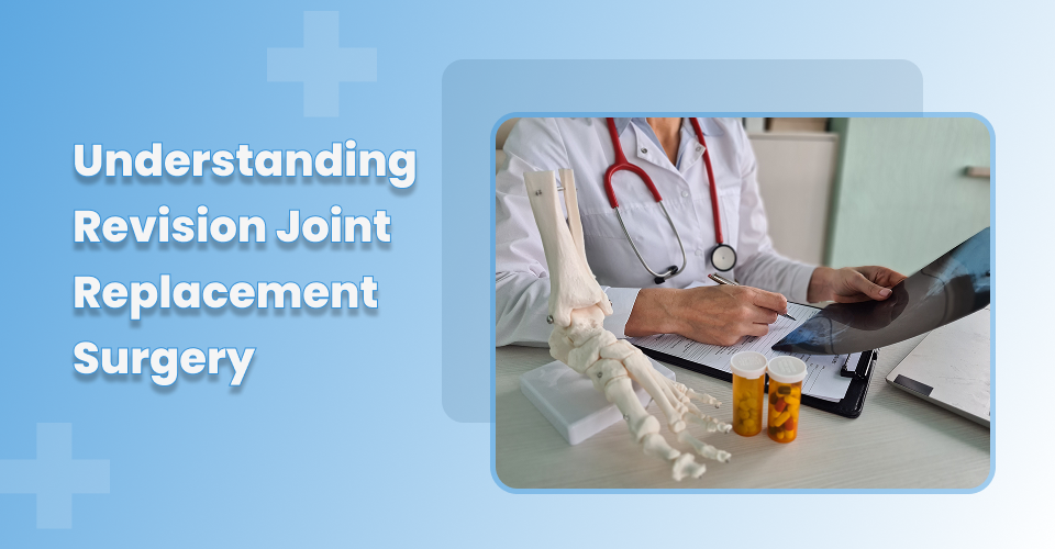 Understanding Revision Joint Replacement Surgery