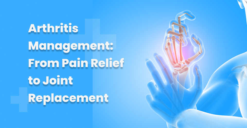 Arthritis Management: From Pain Relief to Joint Replacement